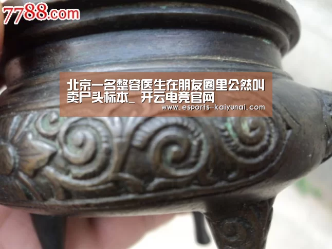 北京一名整容医生在朋友圈里公然叫卖尸头标本_ 开云电竞官网(图2) 开云电竞官网